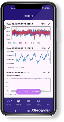 Spica mobile app — record screen with live waveforms